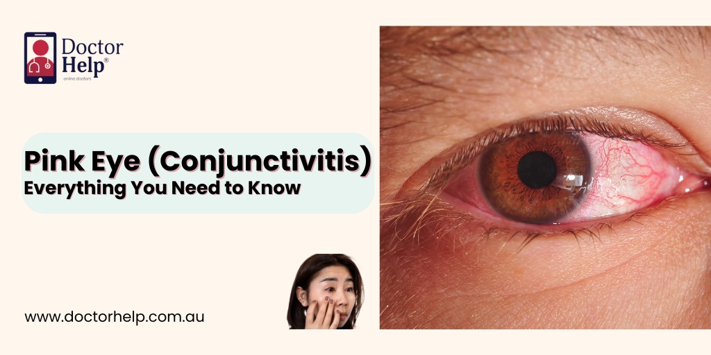 Pink Eye (Conjunctivitis) Everything You Need to Know
