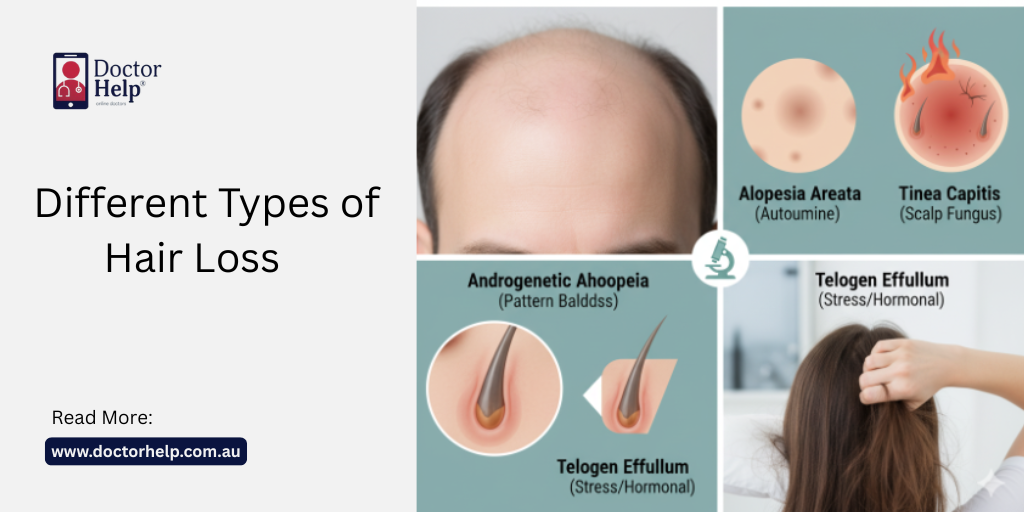 Hair Loss